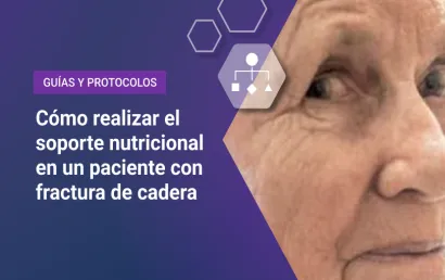 Cómo realizar el soporte nutricional en un paciente con fractura de cadera